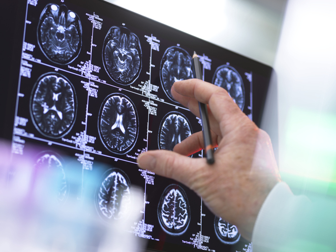 Europe's brain health needs a serious coordination plan